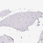 Immunohistochemical staining of human skeletal muscle shows no positivity in myocytes as expected.