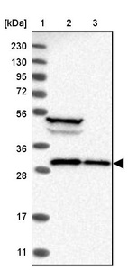 Lane 1: Marker [kDa] 230, 130, 95, 72, 56, 36, 28, 17, 11_br/_Lane 2: Human cell line RT-4_br/_Lane 3: Human cell line U-251MG sp
