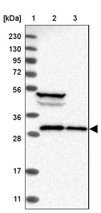 Lane 1: Marker [kDa] 230, 130, 95, 72, 56, 36, 28, 17, 11_br/_Lane 2: Human cell line RT-4_br/_Lane 3: Human cell line U-251MG sp