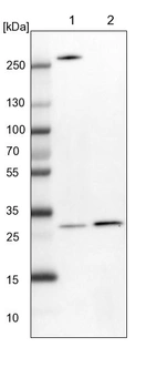 Lane 1: NIH-3T3 cell lysate (Mouse embryonic fibroblast cells)_br/_Lane 2: NBT-II cell lysate (Rat Wistar bladder tumour cells)