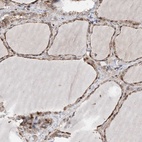 Anti-PLPP3 Antibody