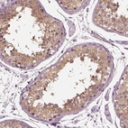 Anti-TRIM69 Antibody