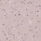 Immunohistochemical staining of human cerebral cortex shows moderate cytoplasmic positivity in neuropil.
