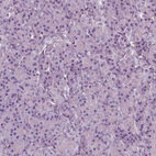 Immunohistochemical staining of human pancreas shows no cytoplasmic positivity in exocrine glandular cells as expected.