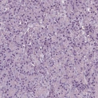 Immunohistochemical staining of human pancreas shows no cytoplasmic positivity in exocrine glandular cells as expected.
