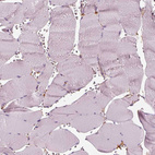 Immunohistochemical staining of human skeletal muscle shows no cytoplasmic positivity in myocytes.