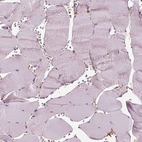 Immunohistochemical staining of human skeletal muscle shows no cytoplasmic positivity in myocytes.