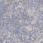 Immunohistochemical staining of human lymph node tissues shows moderate nuclear positivity in non-germinal center cells.