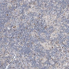 Immunohistochemical staining of human lymph node tissues shows moderate nuclear positivity in non-germinal center cells.