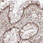 Immunohistochemical staining of human Rectum shows moderate nuclear and cytoplasmic positivity in glandular cells.