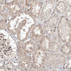 Anti-SMAD7 Antibody