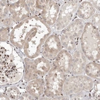 Immunohistochemical staining of human Kidney shows moderate cytoplasmic positivity in cells in tubules.