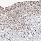 Immunohistochemical staining of human urinary bladder shows moderate nuclear-cytoplasmic positivity in urothelial cells.