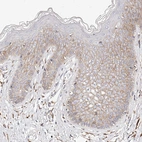 Immunohistochemical staining of human skin shows moderate membranous positivity in keratinocytes.