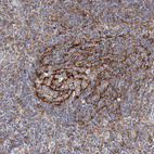 Immunohistochemical staining of human tonsil shows moderate to strong membranous positivity in germinal center cells.