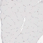 Immunohistochemical staining of human skeletal muscle shows no cytoplasmic positivity in myocytes as expected.