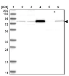 Lane 1: Marker [kDa] 230, 130, 95, 72, 56, 36, 28, 17, 11_br/_Lane 2: Human cell line RT-4_br/_Lane 3: Human cell line U-251MG sp_br/_Lane 4: Human plasma (IgG/HSA depleted)_br/_Lane 5: Human liver tissue_br/_Lane 6: Human tonsil tissue