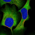 Immunofluorescent staining of human cell line U-2 OS shows localization to plasma membrane & cytosol.