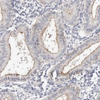 Immunohistochemical staining of human endometrium shows moderate membranous positivity in glandular cells.