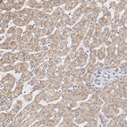 Immunohistochemical staining of human liver shows moderate cytoplasmic positivity in hepatocytes.