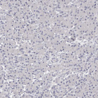 Immunohistochemical staining of human pancreas shows negative cytoplasmic positivity in exocrine glandular cells as expected.