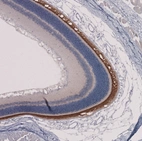 Immunohistochemical staining of rat eye shows strong cytoplasmic positivity in photoreceptor cells in retina.