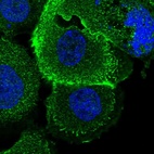Immunofluorescent staining of human cell line A-431 shows localization to plasma membrane & cytosol.