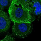 Immunofluorescent staining of human cell line A-431 shows localization to plasma membrane & cytosol.