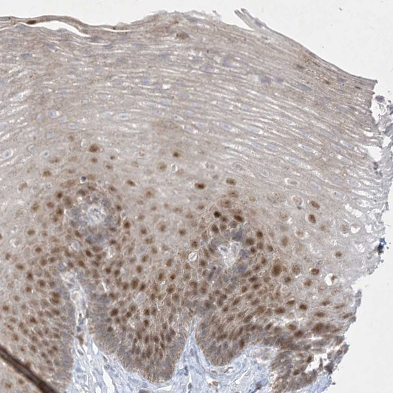 Anti-BHLHE40 Antibody