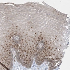 Anti-BHLHE40 Antibody