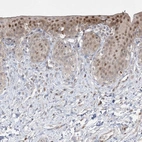 Immunohistochemical staining of human urinary bladder shows moderate nuclear positivity in urothelial cells.