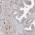 Immunohistochemical staining of human prostate shows moderate cytoplasmic positivity in smooth muscle cells.