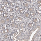 Immunohistochemical staining of human duodenum shows moderate cytoplasmic positivity in glandular cells.