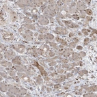 Immunohistochemical staining of human pancreas shows moderate cytoplasmic positivity in exocrine glandular cells.