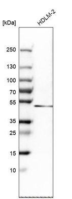 Western blot analysis in human cell line HDLM-2.