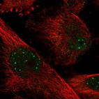 Immunofluorescent staining of human cell line U-251 MG shows localization to nuclear bodies.