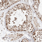 Immunohistochemical staining of human Testis shows strong nuclear positivity in cells in seminiferous ducts.