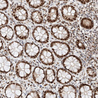 Immunohistochemical staining of human lower Rectum shows strong nuclear positivity in glandular cells.
