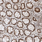 Immunohistochemical staining of human lower Rectum shows strong nuclear positivity in glandular cells.