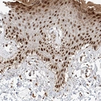 Immunohistochemical staining of human Skin shows moderate nuclear positivity in squamous epithelial cells.