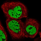 Immunofluorescent staining of human cell line A-431 shows localization to nucleoplasm.