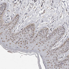 Immunohistochemical staining of human Skin shows moderate nuclear positivity in squamous epithelial cells.