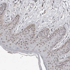 Immunohistochemical staining of human Skin shows moderate nuclear positivity in squamous epithelial cells.