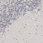 Immunohistochemical staining of human Cerebellum shows moderate nuclear positivity in Purkinje cells.