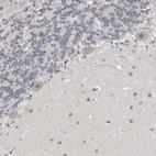 Immunohistochemical staining of human Cerebellum shows moderate nuclear positivity in Purkinje cells.