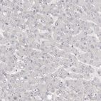 Immunohistochemical staining of human Liver shows very weak nuclear positivity in hepatocytes.