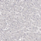 Immunohistochemical staining of human Liver shows very weak nuclear positivity in hepatocytes.