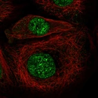 Immunofluorescent staining of human cell line A-431 shows localization to nucleoplasm.