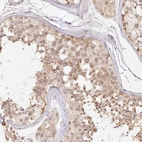 Anti-ELL3 Antibody