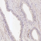 Immunohistochemical staining of human Prostate shows no positivity in glandular cells as expected.